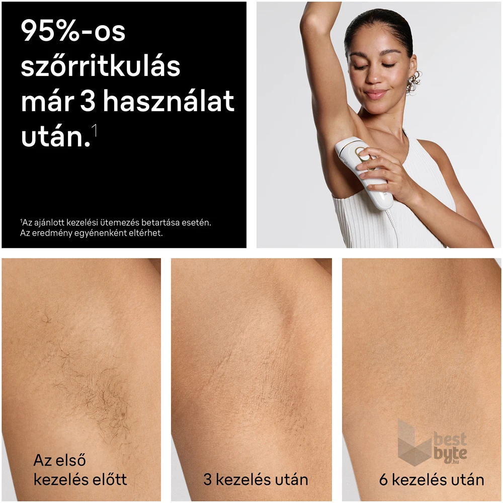 BRAUN Silk-Expert IPL PL5210 villanófényes szőrtelenítő