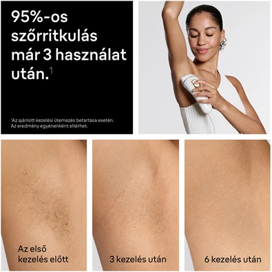 BRAUN Silk-Expert IPL PL5210 villanófényes szőrtelenítő