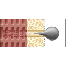 CELO Resitherm 120-160 mm szigetelés vastagsághoz rögzítő szett